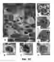 Fig. 04 - HAR-NDS-derived stem cells, method for separating same, and use thereof