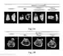 Fig. 04 - Combination therapy for ameliorating adverse side effects caused by chemotherapy