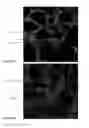Fig. 17 - POLARIZED HYDROXYAPATITE FILMS AND METHODS OF MAKING AND USING SAME