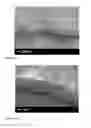 Fig. 19 - POLARIZED HYDROXYAPATITE FILMS AND METHODS OF MAKING AND USING SAME