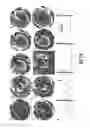Fig. 15 - Engineered cardiac derived compositions and methods of use