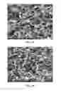 Fig. 05 - Collagen scaffolds, medical implants with same and methods of use