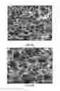 Fig. 10 - Collagen scaffolds, medical implants with same and methods of use
