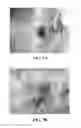 Fig. 11 - Collagen scaffolds, medical implants with same and methods of use