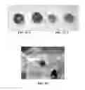 Fig. 12 - Collagen scaffolds, medical implants with same and methods of use