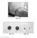 Fig. 13 - Collagen scaffolds, medical implants with same and methods of use