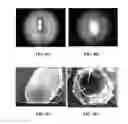 Fig. 14 - Collagen scaffolds, medical implants with same and methods of use