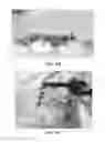 Fig. 26 - Collagen scaffolds, medical implants with same and methods of use