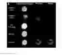 Fig. 01 - Methods for preparation of a terminally sterilized hydrogel derived from extracellular matrix