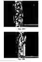 Fig. 14 - Methods for preparation of a terminally sterilized hydrogel derived from extracellular matrix