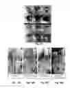 Fig. 16 - Methods for preparation of a terminally sterilized hydrogel derived from extracellular matrix