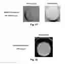 Fig. 17 - Methods for preparation of a terminally sterilized hydrogel derived from extracellular matrix