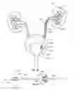 Fig. 04 - Ureteral stents