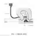 Fig. 02 - Device for assisting access to a subcutaneous port