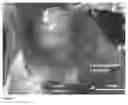 Fig. 02 - Method of providing agents to the cochlea