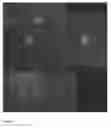 Fig. 03 - Method of providing agents to the cochlea