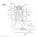 Fig. 02 - Method and stimulation system for stimulating a human leg