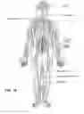 Fig. 02 - SYSTEM AND METHOD FOR TREATMENT OF PAIN RELATED TO LIMB JOINT REPLACEMENT SURGERY