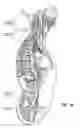 Fig. 03 - SYSTEM AND METHOD FOR TREATMENT OF PAIN RELATED TO LIMB JOINT REPLACEMENT SURGERY