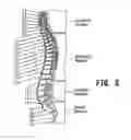 Fig. 04 - SYSTEM AND METHOD FOR TREATMENT OF PAIN RELATED TO LIMB JOINT REPLACEMENT SURGERY