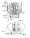 Fig. 05 - SYSTEM AND METHOD FOR TREATMENT OF PAIN RELATED TO LIMB JOINT REPLACEMENT SURGERY