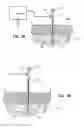 Fig. 07 - SYSTEM AND METHOD FOR TREATMENT OF PAIN RELATED TO LIMB JOINT REPLACEMENT SURGERY