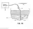 Fig. 08 - SYSTEM AND METHOD FOR TREATMENT OF PAIN RELATED TO LIMB JOINT REPLACEMENT SURGERY