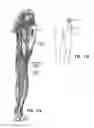 Fig. 12 - SYSTEM AND METHOD FOR TREATMENT OF PAIN RELATED TO LIMB JOINT REPLACEMENT SURGERY