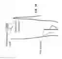 Fig. 15 - SYSTEM AND METHOD FOR TREATMENT OF PAIN RELATED TO LIMB JOINT REPLACEMENT SURGERY