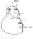 Fig. 12 - TRANSCRANIAL CURRENT STIMULATION (TCS) APPARATUS