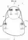 Fig. 13 - TRANSCRANIAL CURRENT STIMULATION (TCS) APPARATUS