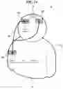 Fig. 15 - TRANSCRANIAL CURRENT STIMULATION (TCS) APPARATUS