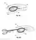 Fig. 06 - Fixation of a removable magnet or a similar element in an elastic implant material