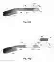 Fig. 08 - Fixation of a removable magnet or a similar element in an elastic implant material