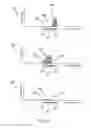 Fig. 11 - System and method for managing stimulation of select A-beta fiber components