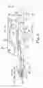 Fig. 10 - Catheter and electrode systems for electrical neuromodulation