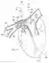 Fig. 01 - Methods for electrical neuromodulation of the heart