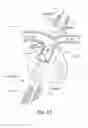 Fig. 02 - Methods for electrical neuromodulation of the heart