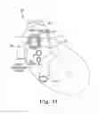 Fig. 04 - Methods for electrical neuromodulation of the heart