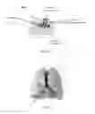 Fig. 05 - Multi-Tiered Wireless Powering System for Long-Term Implantable Medical Devices