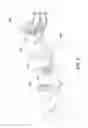 Fig. 06 - Oral treatment device