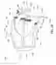Fig. 20 - Oral treatment device
