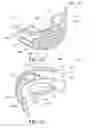 Fig. 14 - Oral treatment device