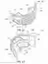 Fig. 14 - Oral treatment device