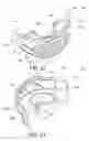 Fig. 14 - Oral treatment device