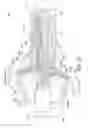 Fig. 16 - Oral treatment device
