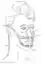 Fig. 01 - METHOD AND APPARATUS FOR TOOTH REGULATION WITH HEAVY FORCES