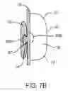 Fig. 09 - METHOD AND APPARATUS FOR TOOTH REGULATION WITH HEAVY FORCES