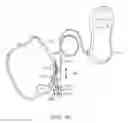Fig. 23 - METHOD AND APPARATUS FOR TOOTH REGULATION WITH HEAVY FORCES