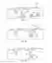 Fig. 41 - SYSTEMS AND METHODS FOR TREATING DERMATOLOGICAL IMPERFECTIONS